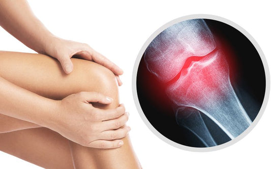  Best Ingredients for Bone and Joint Health Supplements